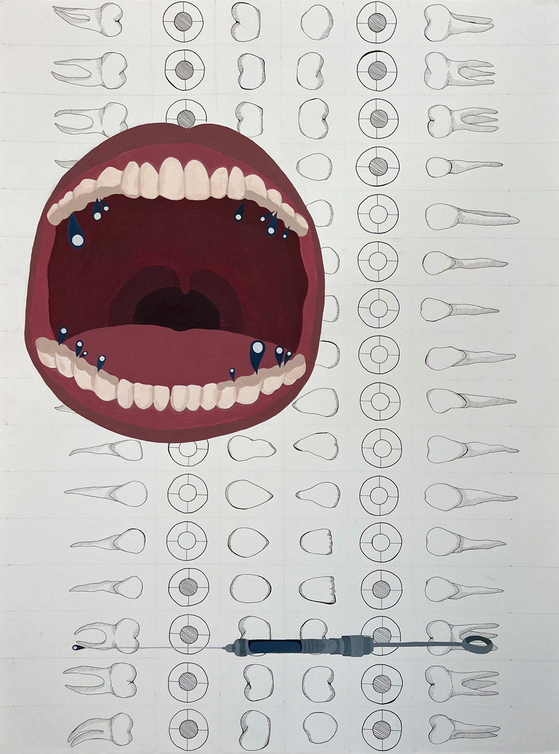 Novocaine